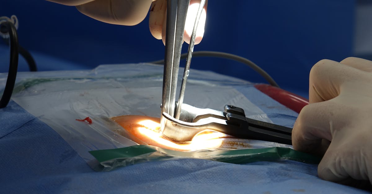 discover everything you need to know about spinal stenosis, its causes, symptoms, and effective treatment options. learn how to manage this condition and improve your quality of life with expert insights and resources.