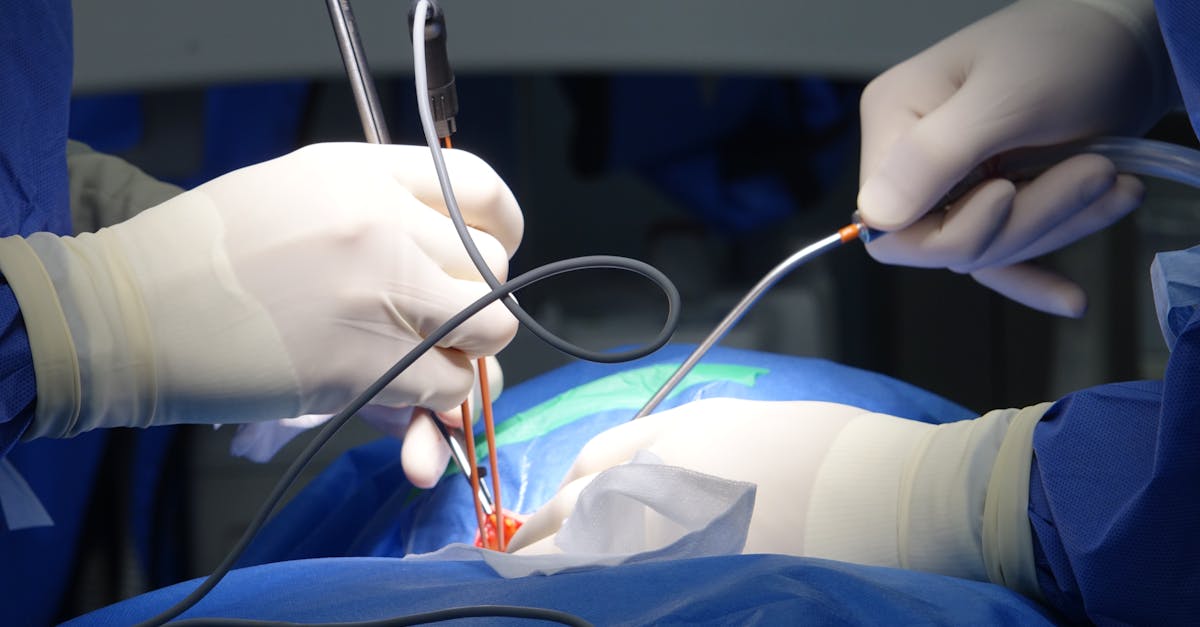 explore the causes, symptoms, and treatment options for a herniated disc. learn how this condition affects the spine, its impact on daily life, and discover effective strategies for relief and recovery.